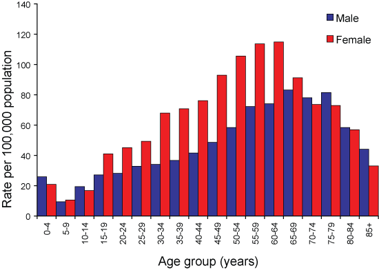 Figure 50. Notification rate of pertussis, Australia, 2006, by age group and sex