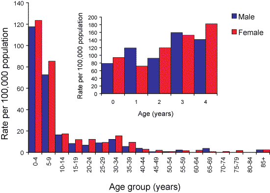 Figure 57. Notification rate of chickenpox, Australia, 2006, by age group and sex