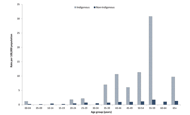 Figure 41: Rates of laboratory confirmed influenza A(H1N1)pdm09 associated