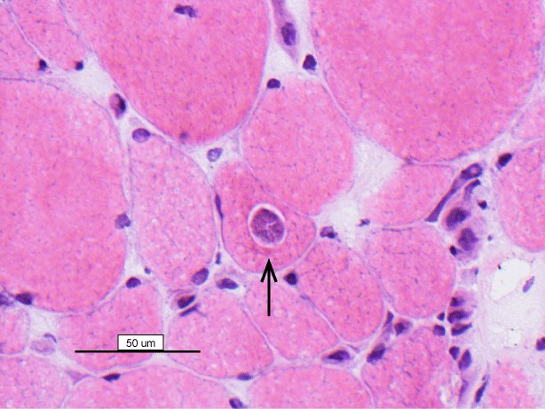 Cryostat section, haematoxylin-eosin stain, x 400 magnification