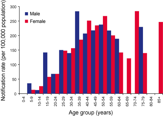 Figure 20. Notification rate for Ross River virus infections, Northern Territory, 1 July 2005 to 30 June 2006, by age group and sex