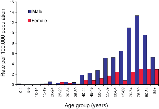 Figure 63. Notification rates of legionellosis, Australia, 2004, by age group and sex 