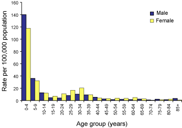 Figure 17. Notification rates of cryptosporidiosis, Australia, 2002, by age group and sex
