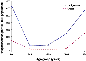 Figure 6. Hospitalisation rate for influenza and all pneumonia combined, Australia, 1999 to 2002, by age group and Indigenous status