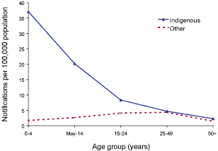 Figure 1. Hepatitis A notification rate, selected Australian States, 2000 to 2002, by age group and Indigenous status
